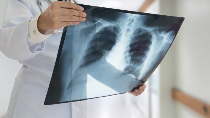 uls-de-castelo-branco-investe-700-mil-euros-em-tomografia-axial-computadorizada-no-serviyo-de-imagiologia
